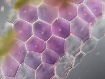 Leucoplasto Leucoplasto