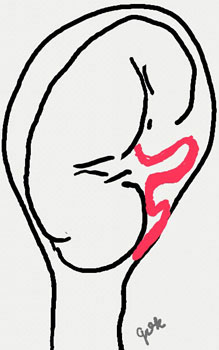 Cordão Umbilical