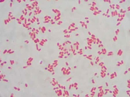 Escherichia coli