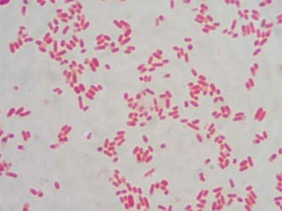 Escherichia coli