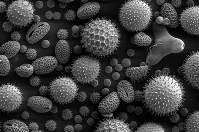Esporos fósseis vistos sob microscopia(microfósseis)