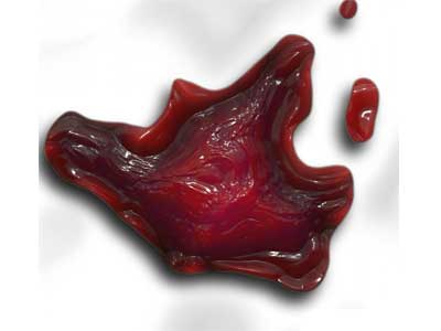 Trombocitemia Essencial