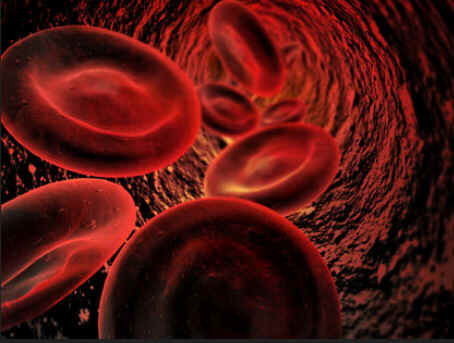 Eritroblastose Fetal Eritroblastose Fetal
