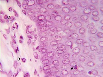 Células Plasmáticas