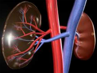Tumor de Wilms