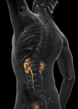 Hiperuricemia
