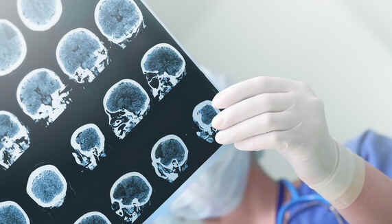 Neurologista Neurologista