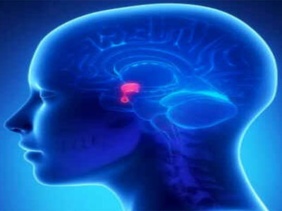 Hiperprolactinemia