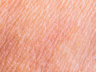 Dermatologia