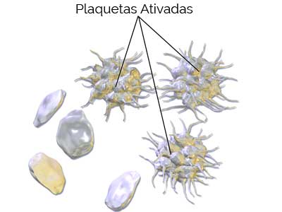 Plaquetas