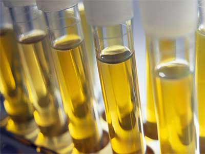 Toxicologia