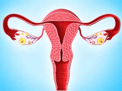 Adenoma