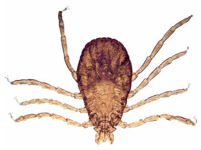 Rickettsiose