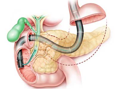 Colangiografia