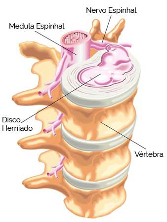 Coluna Cervical