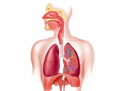 Pneumonia por aspiração