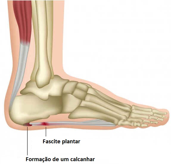 Aponeurose palmar Aponeurose palmar