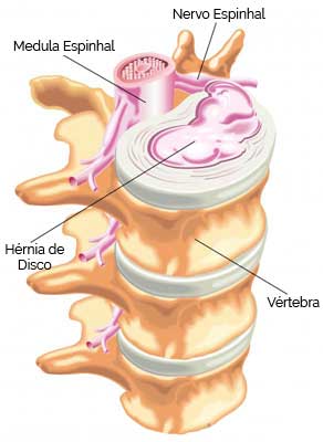 Coluna Vertebral