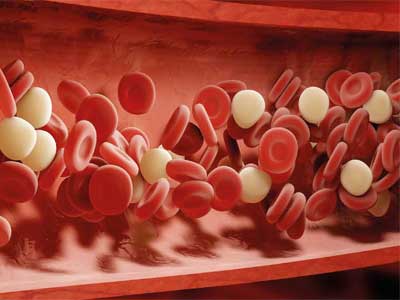 Hiperlipoproteinemia
