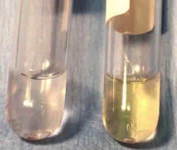 Xantocromia