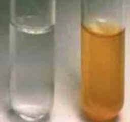Xantocromia