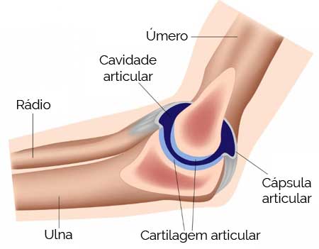 Fratura de Úmero