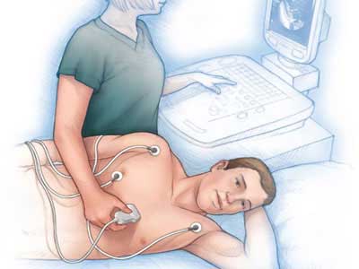 Ecocardiograma