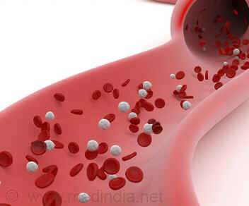 Hipercalcemia