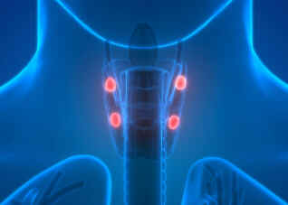 Hipercalcemia