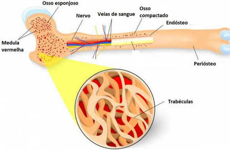 Hiperostose