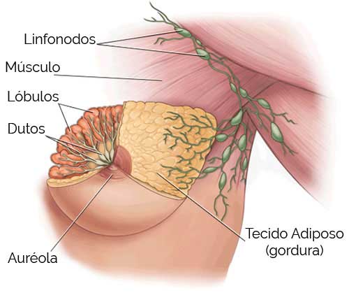 Ultrassonografia Mamária