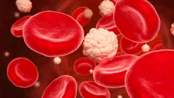 Hiperinsulinemia