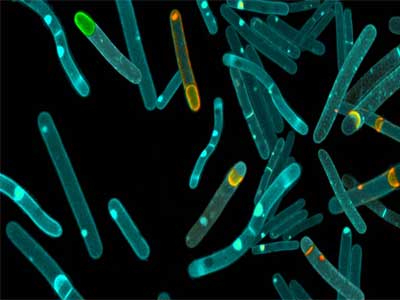 Esporo Bacteriano