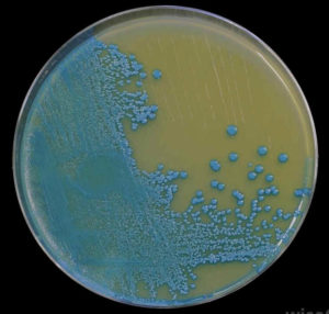 Archaea