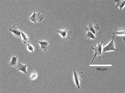 Fibroblasto