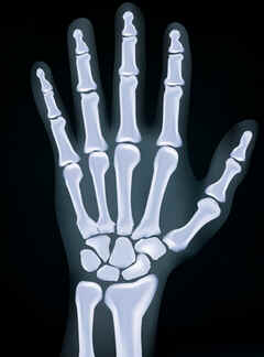 Radiografia