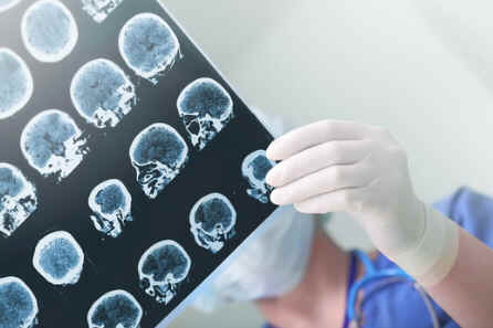 Radiografia