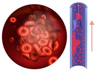 Alimentos Anticoagulantes