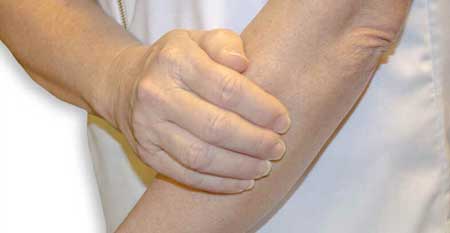 Parestesia