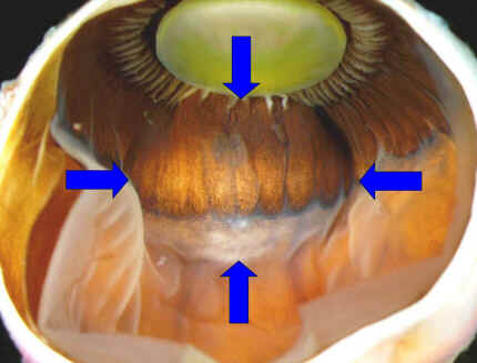 Corpo ciliar