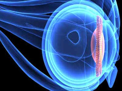 Corpo ciliar