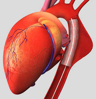 Aorta