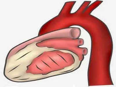 Aorta descendente