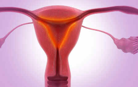 Endometrite