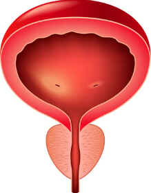 Prostatite