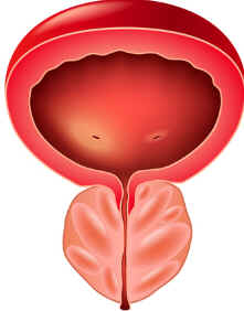 Prostatite