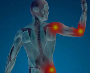 Sarcoma